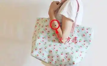 胳膊上痣图解痣相图解