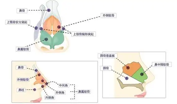 鼻部多项里面的鼻小柱和鼻中隔必须都是什么啊?