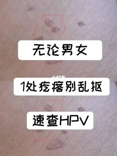无论男女:1处疙瘩别乱抠,速查hpv