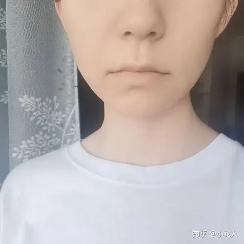 我的嘴唇很白,没有一点血色.可是又不贫血是为什么?