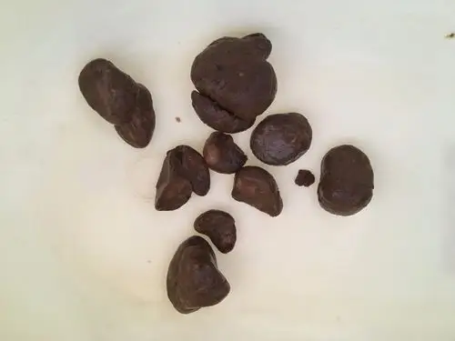 孩子18个月每天不少吃菜喝水,最近一段时间大便干燥成颗粒状,比羊粪球