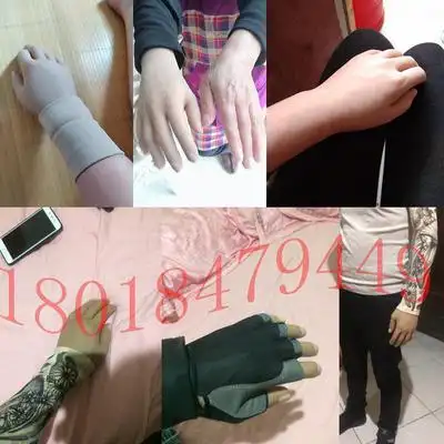 硅胶假手指套残疾人假手肢仿真定制手皮手臂义肢机械手指肌电手套