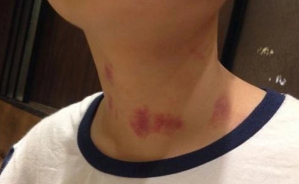 男孩跟女友关系非常好,第二天男孩却突然倒地,意外死亡了