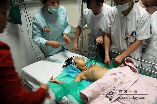 江西6岁女孩已经抵沪救治_深圳论坛_爱卡汽车