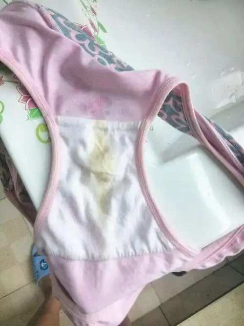 前几天芸芸发现女儿的内裤总会有黄色的分泌物,也不像是尿渍,这让芸芸