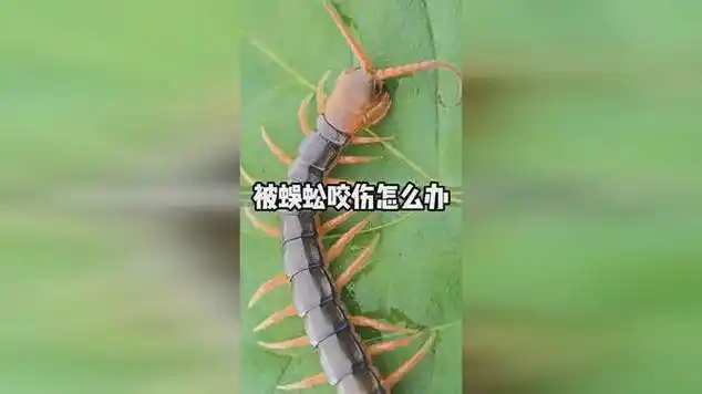 如果被蜈蚣咬伤了该怎么办?|传染科疾病|害虫_网易视频