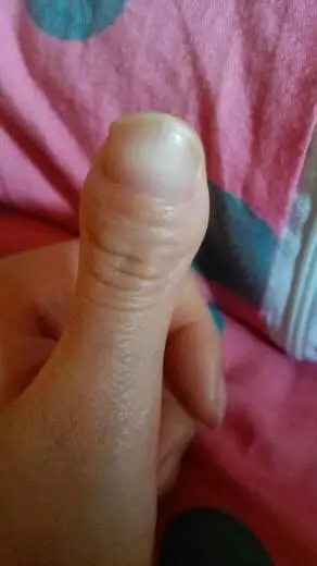 我的大拇指又短又粗又扁,整个形状呈蛇头状,有什么古老说法吗?