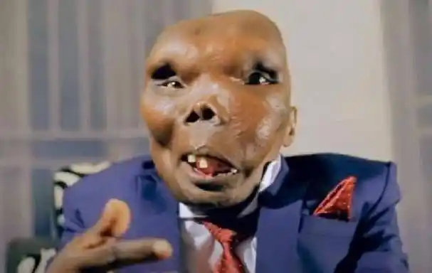 作为"世界上最丑的男人",他在事业和爱情上都取得了成功:作为歌手一夜