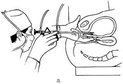 膀胱镜检查多少钱?女性膀胱镜疼不疼?