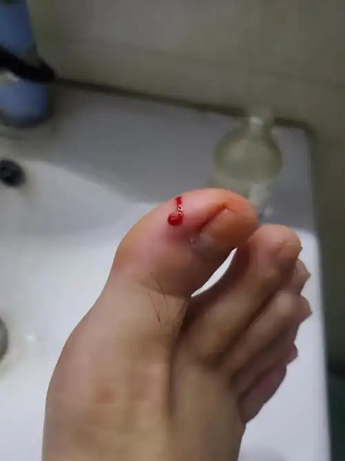 慎入刚才被老鼠咬了