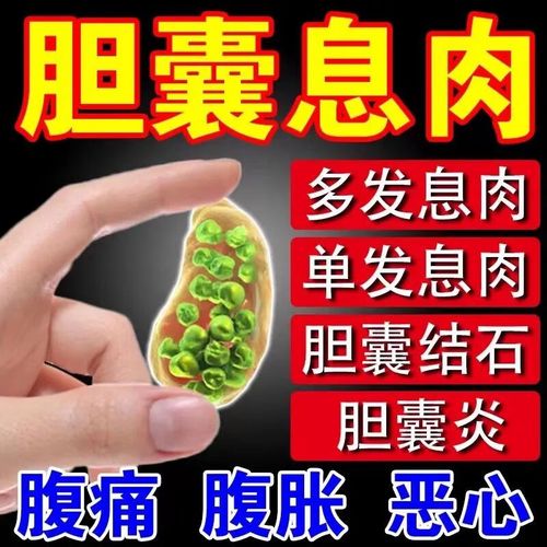药房直售  【药房直售】胆囊息肉石排i石胆囊结石克星腹部绞痛 胆康贴