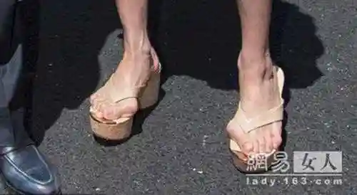 被拍到她穿着人字拖凉鞋的脚趾严重变形,大拇指紧压着第二根指头,让人