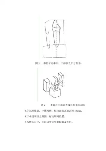 上颌切牙雕刻附图