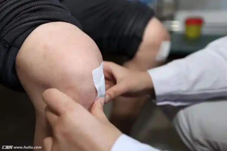 春秋分穴位贴敷开始啦