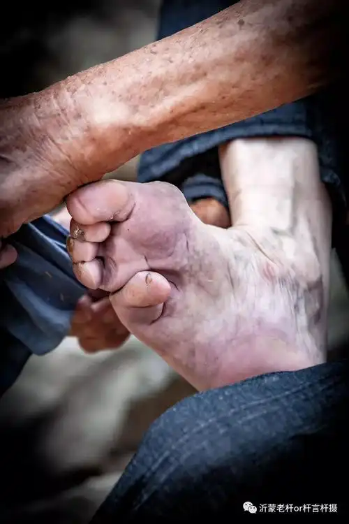 临沂小脚老太太无声诉说着女性的血泪史图片有点恐怖请不要随意打开