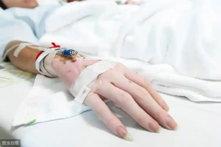 结束9次癌症化疗,经历生死,告诉你化疗到底有多痛苦?