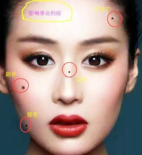 俗话说面无善痣那么脸上哪些痣是不好的呢下面我们来找找