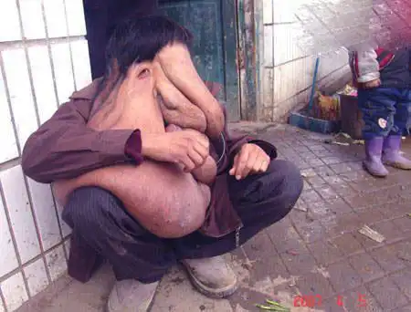 世界上最恶心的人又丑又恶心的男人和女人图片