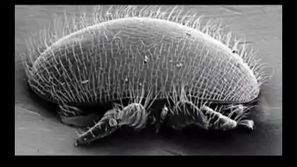 头部堆满了剪发虫,记住两个灭虫法.#剪发虫