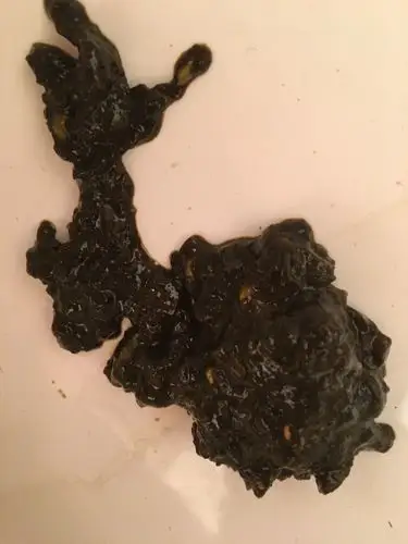 柏油样便,排除吃了动物血制品,铁剂等,如果无原因的拉这样的大便,就