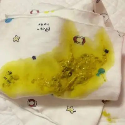 宝宝第7天,这两天总是拉这样的屎,肚子还咕噜咕噜