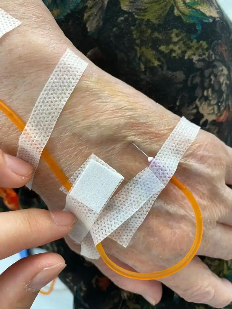 今天给一位70多岁的奶奶扎滴流,刚扎进去不一会,奶奶说有滋拉滋啦的