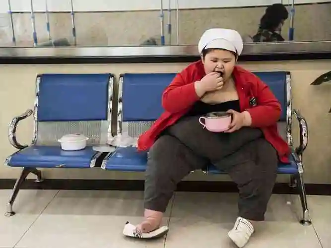 宝宝患有小胖威利综合征