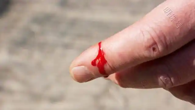 相信大家都有这样的经历,生活中,因意外不小心划破了手指,明明只有一