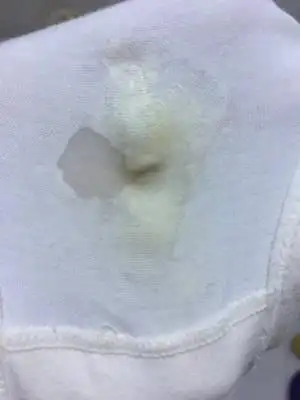 我怀孕22周分泌物增多有时候是白色乳状有时候掺杂水状,到内裤上干了