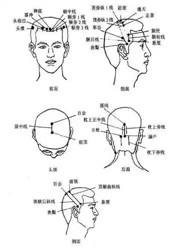 头针穴名标准化方案