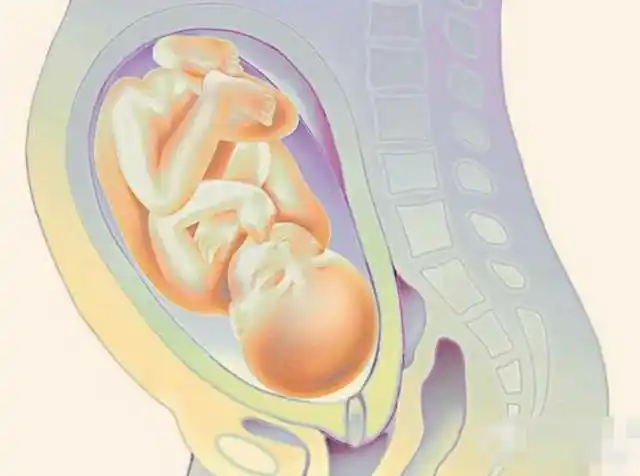 大部分胎儿的头部已经进入骨盆,那约有3%~4%的胎儿的臀部,或小腿会