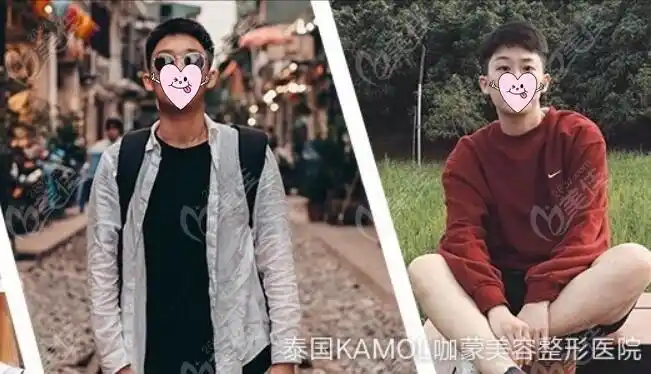 泰国kamol咖蒙能做变性手术吗这是女变男男变女实例效果哦