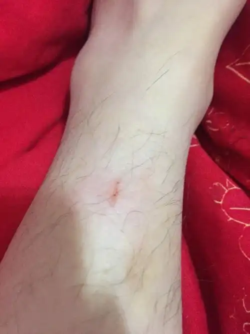 今天 00:26 网友采纳   破皮并出血了,你狗狗打过狂犬病疫苗吗?