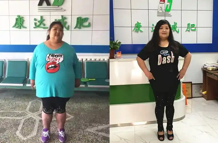 320斤我都经历了什么?