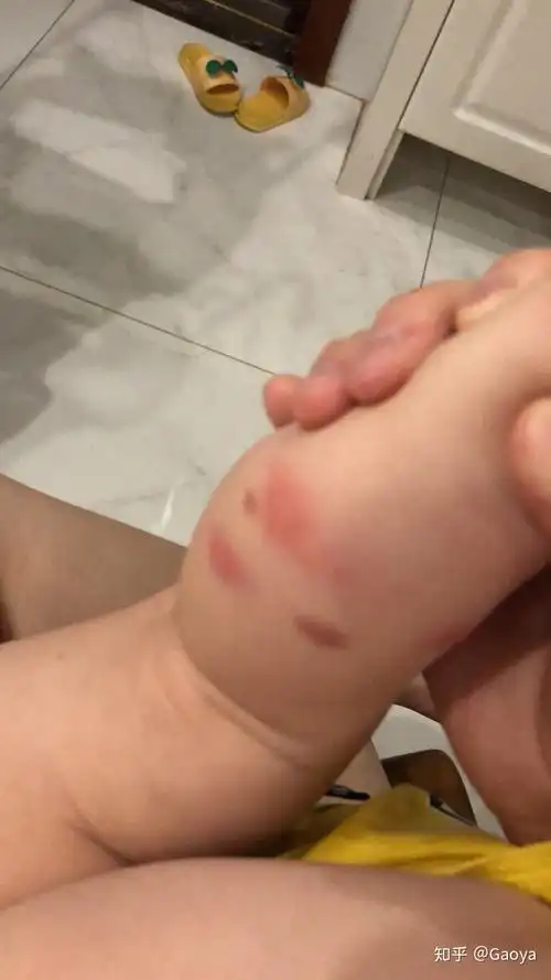 墙上地板上棕色带壳虫咬人