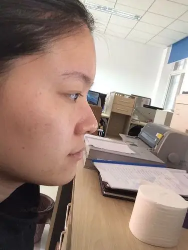 我的下巴整体都突出来超过鼻子了,脸型(国字脸)因为这个下颚突出的