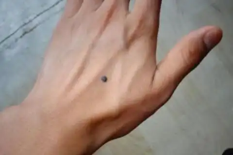 右手手背上长痣图解大全