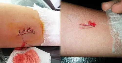 最近有网友爆料某医院的护士,在为小孩拔针时,护士毫