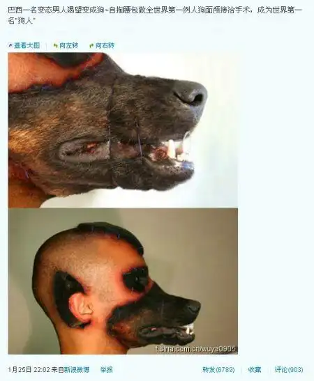 "巴西男子做人狗面颅接合手术"消息失实(转自新浪微博)