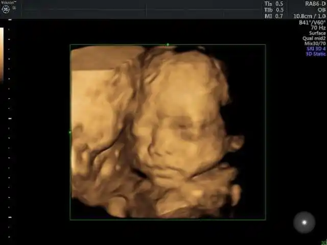 今天去做四维彩超,问医生给宝宝买什么衣服合适,医生说跟我差不多是