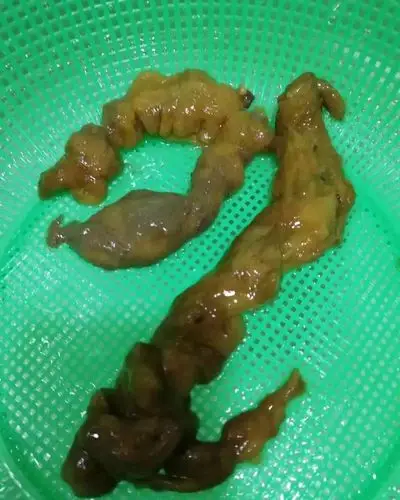 淡斑,青春痘,敏感,缺水);2,改善便秘,改善排便质量,清除宿便及废油脂