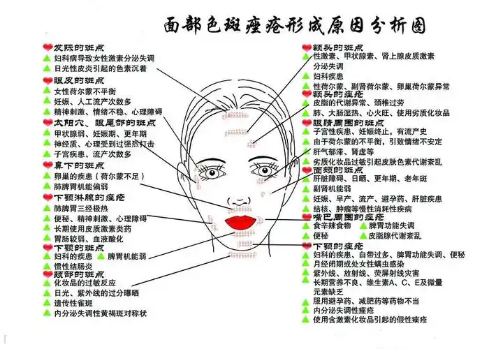 长斑的位置图解44
