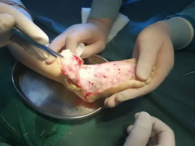 西安冶金医院烧伤整形科