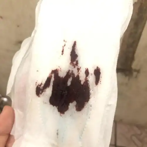 求求帮助下面异常流血有图慎入