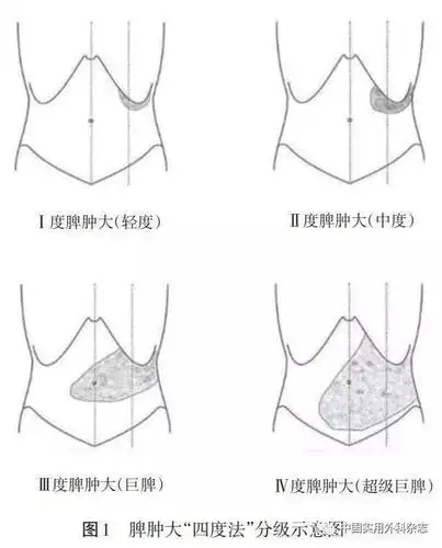 脾脏外科临床研究进展与展望