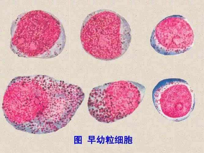 早幼粒细胞