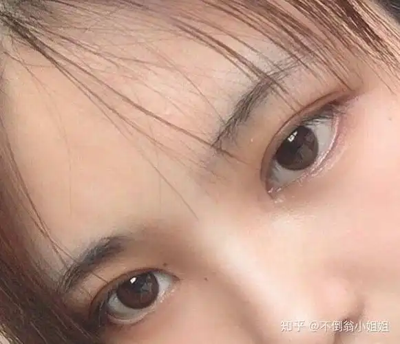 看到最近流行割小平扇双眼皮小平扇是属于什么形状它和平扇开扇区别在