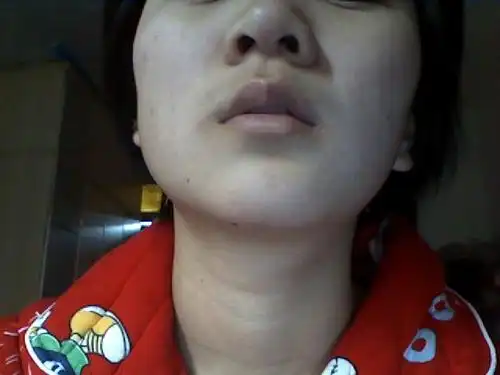 我的脸感觉总是歪的