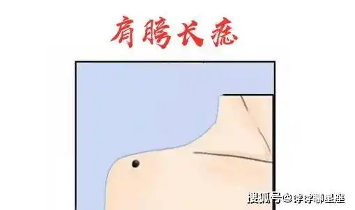 肩膀长痣在相学中,若是一个人的肩膀的位置处长有吉痣,则说明这样的人