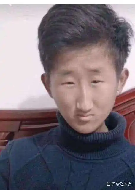 单眼皮肿眼泡小眼睛是一种什么体验?